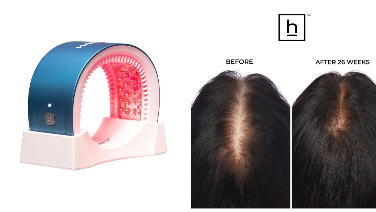 HairMax LaserBand 82 ComfortFlex: The Ultimate Solution for Thicker, Healthier Hair